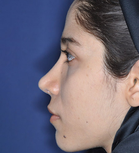 وبسایت دکتر مهدی غلامی، متخصص جراحی بینی، جراحی فک و صورت و جراحی ایمپلنت در مشهد