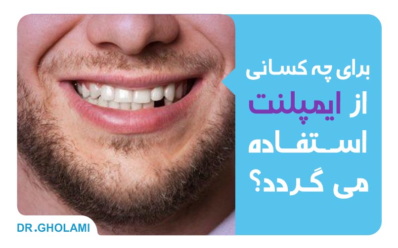برای چه کسانی از ایمپلنت دندان استفاده میگردد؟