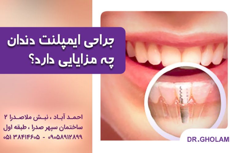 جراحی ایمپلنت دندان چه مزایایی دارد؟