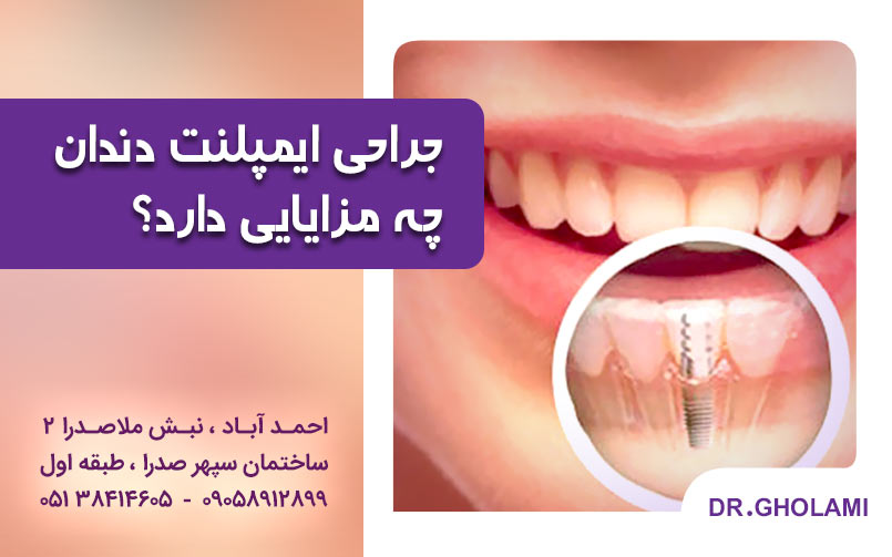 جراحی ایمپلنت دندان چه مزایایی دارد؟