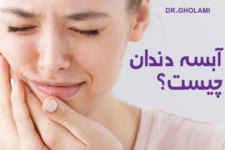 درمان آبسه دندان در مشهد