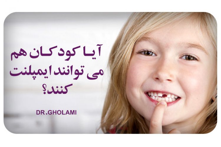 ایمپلنت برای کودکان در مشهد