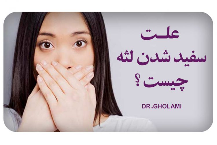 درمان سفید شدن لثه و ایمپلنت در مشهد